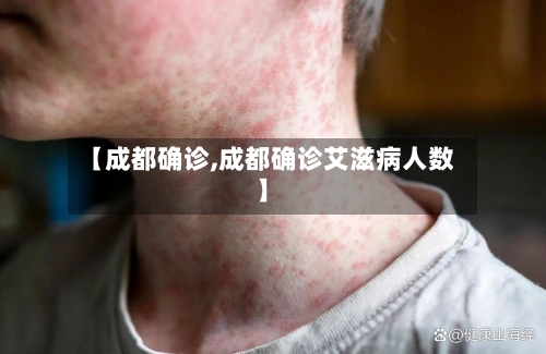 【成都确诊,成都确诊艾滋病人数】